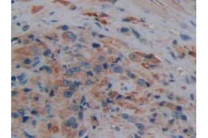 Used in DAB staining on fromalin fixed paraffin- embedded kidney tissue (Aquaporin 1 anticorps  (AA 201-269))