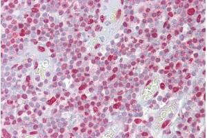 Immunohistochemistry with Tonsil tissue at an antibody concentration of 5µg/ml using anti-H2AFX antibody (ARP58281_P050)