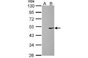 WB Image Cannabinoid Receptor 1 antibody [C1C2], Internal detects CNR1 protein by Western blot analysis.