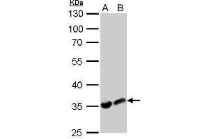 WB Image LDHA antibody detects LDHA protein by Western blot analysis.