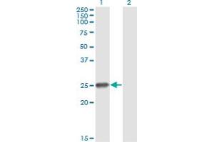 Western Blot analysis of RNF114 expression in transfected 293T cell line by ZNF313 monoclonal antibody (M03), clone S2.