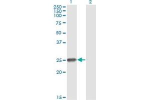 Western Blot analysis of RNF114 expression in transfected 293T cell line by ZNF313 monoclonal antibody (M03), clone S2. (RNF114 anticorps  (AA 1-228))