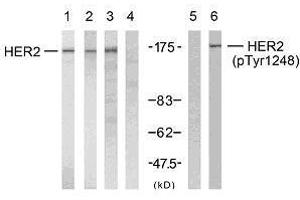 Western blot analysis using HER2 (Ab-1248) antibody (E021072, Line 1, 2, 3 and 4) and HER2 (phospho- Tyr1248) antibody (E011079, Line 5 and 6). (ErbB2/Her2 anticorps)