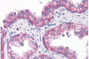 Human Prostate: Formalin-Fixed, Paraffin-Embedded (FFPE)