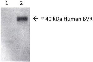Western blot analysis of Human, Rat Brain cell lysates showing detection of BVR protein using Rabbit Anti-BVR Polyclonal Antibody . (Biliverdin Reductase anticorps  (HRP))