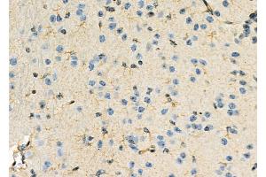 ABIN6263006 and ABIN6274023 at 1/100 staining Mouse brain tissue by IHC-P.