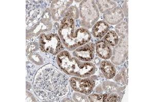 Immunohistochemical staining of human kidney with CEP85L polyclonal antibody  shows strong cytoplasmic positivity in cells of tubules at 1:10-1:20 dilution. (C6orf204 anticorps)