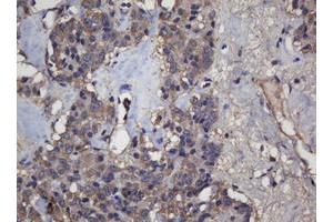 Immunohistochemistry (IHC) image for anti-Crystallin, alpha A (CRYAA) antibody (ABIN1498754)