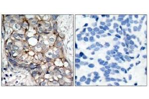 Image no. 3 for anti-Epidermal Growth Factor Receptor (EGFR) (AA 1068-1072) antibody (ABIN197228) (EGFR anticorps  (AA 1068-1072))