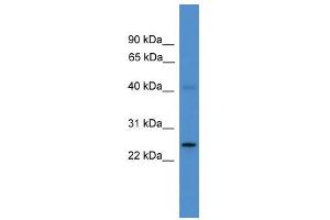 WB Suggested Anti-UCHL1 Antibody Titration: 0. (UCHL1 anticorps  (C-Term))