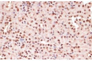 Immunohistochemistry of paraffin-embedded Mouse kidney using Phospho-ATF2(T71) Polyclonal Antibody at dilution of 1:100 (40x lens). (ATF2 anticorps  (pThr71))
