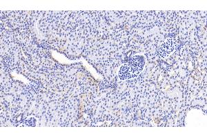 Detection of GCDH in Human Kidney Tissue using Polyclonal Antibody to Glutaryl Coenzyme A Dehydrogenase (GCDH)