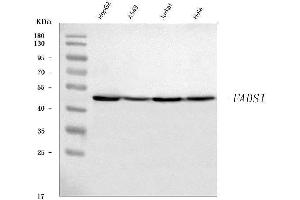 Western blot analysis of FADS1 using anti-FADS1 antibody (ABIN7599175).