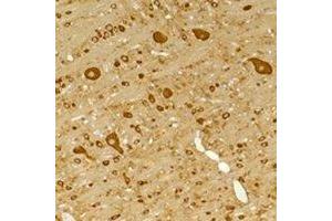 Immunohistochemical analysis of GABRG2 staining in rat brain,mouse brain formalin fixed paraffin embedded tissue section. (GABRG2 anticorps)