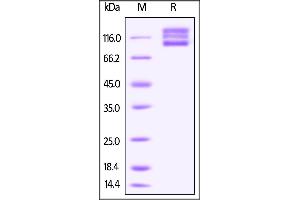 Human ITGAV & ITGB8 Heterodimer Protein on SDS-PAGE under reducing (R) condition. (ITGAV/ITGB8 Protein (AA 31-992) (His tag))