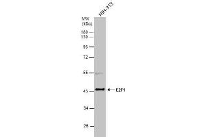 WB Image Whole cell extract (30 μg) was separated by 10% SDS-PAGE, and the membrane was blotted with E2F1 antibody , diluted at 1:3000. (E2F1 anticorps)