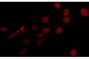 ABIN6266747 staining LOVO by IF/ICC. (FOXJ1 anticorps  (Internal Region))