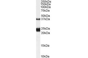 Image no. 1 for anti-Galanin Receptor 1 (GALR1) (Internal Region) antibody (ABIN374858) (Galanin Receptor 1 anticorps  (Internal Region))
