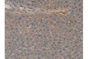 Detection of APOH in Mouse Liver Tissue using Polyclonal Antibody to Apolipoprotein H (APOH)