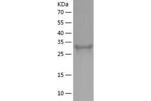 Western Blotting (WB) image for Nudix (Nucleoside Diphosphate Linked Moiety X)-Type Motif 9 (NUDT9) (AA 47-350) protein (His-IF2DI Tag) (ABIN7124247)