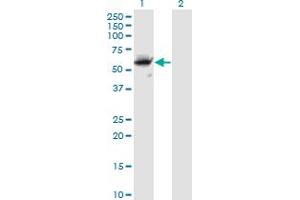 Western Blot analysis of CFLAR expression in transfected 293T cell line by CFLAR monoclonal antibody (M01), clone 2F12.