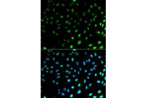 Immunofluorescence analysis of MCF7 cell using S100A8 antibody. (S100A8 anticorps  (AA 1-93))