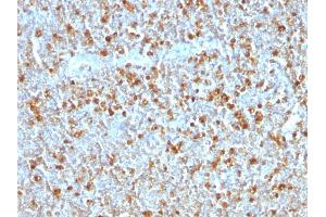 Formalin-fixed, paraffin-embedded human Tonsil stained with Alpha-1-Antitrypsin Mouse Monoclonal Antibody (AAT/1379). (SERPINA1 anticorps)
