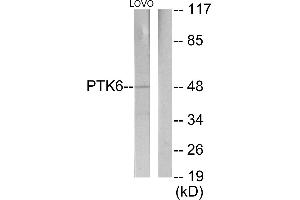 Western blot analysis of extracts from LOVO cells, using Breast Tumor Kinase antibody. (PTK6 anticorps)