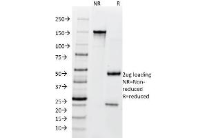 SDS-PAGE Analysis Purified BCL10 Mouse Monoclonal Antibody (SPM520). (BCL10 anticorps  (AA 122-168))
