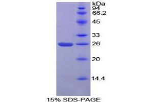SDS-PAGE analysis of Mouse PICK1 Protein. (PICK1 Protéine)