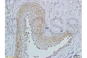 Formalin-fixed and paraffin embedded rat ovary tissue labeled with (ABIN729508) Rabbit Anti-FSH receptor Polyclonal Antibody, Unconjugated1:200 followed by conjugation to the secondary antibody and DAB staining.