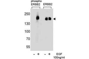 Western blot analysis of extracts from A431 cells, untreated or treated with EGF (100ng/ml), using phos-ERBB2 antibody (left) or nonphos Ab (right) (ErbB2/Her2 anticorps  (pTyr1127))