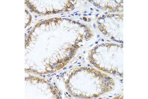 Immunohistochemistry of paraffin-embedded human stomach using GPM6A antibody at dilution of 1:100 (x40 lens). (GPM6A anticorps)