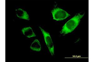 Immunofluorescence of monoclonal antibody to SPATA2 on HeLa cell. (SPATA2 anticorps  (AA 422-519))
