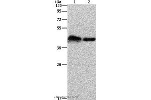 Western blot analysis of Mouse bladder tissue and 293T cell, using CRELD1 Polyclonal Antibody at dilution of 1:930 (CRELD1 anticorps)