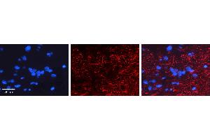 RGS6 antibody - C-terminal region          Formalin Fixed Paraffin Embedded Tissue:  Human Pineal Tissue    Observed Staining:  Cytoplasm and Membrane of Human Pineal Tissue   Primary Antibody Concentration:  1:100    Other Working Concentrations:  1/600    Secondary Antibody:  Donkey anti-Rabbit-Cy3    Secondary Antibody Concentration:  1:200    Magnification:  20X    Exposure Time:  0.