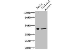 Western Blot Positive WB detected in: Mouse brain tissue, Mouse skeletal muscle tissue All lanes: FAM43A antibody at 3 μg/mL Secondary Goat polyclonal to rabbit IgG at 1/50000 dilution Predicted band size: 46 kDa Observed band size: 46 kDa (FAM43A anticorps  (AA 1-200))