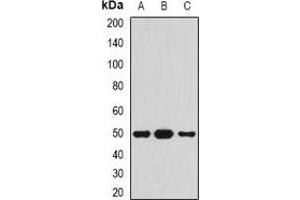 Western blot analysis of Serpin A4 expression in HepG2 (A), mouse pancreas (B), rat pancreas (C) whole cell lysates. (SERPINA4 anticorps)