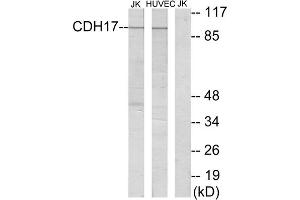 Western blot analysis of extracts from Jurkat cells and HUVEC cells, using CDH17 antibody. (LI Cadherin anticorps  (Internal Region))