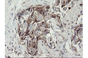 Image no. 9 for anti-Methionyl Aminopeptidase 2 (METAP2) (AA 2-212) antibody (ABIN1491153) (METAP2 anticorps  (AA 2-212))