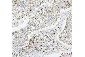 IHC analysis of CD43 using anti-CD43 antibody (ABIN7601042). (CD43 anticorps  (AA 272-400))