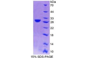 Image no. 1 for phosphofructokinase, Platelet (PFKP) (AA 247-473) protein (His tag) (ABIN4988836)