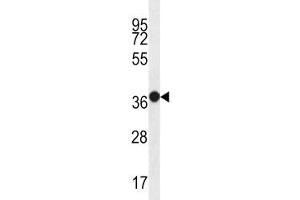 MUC15 antibody western blot analysis in WiDr lysate.