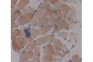 Used in DAB staining on fromalin fixed paraffin- embedded Kidney tissue