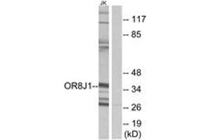 Western blot analysis of extracts from Jurkat cells, using OR8J1 Antibody. (OR8J1 anticorps  (AA 233-282))