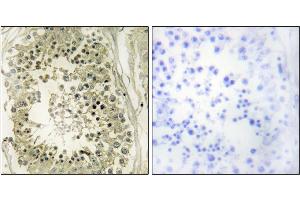 Immunohistochemistry analysis of paraffin-embedded human testis tissue using HGS antibody.