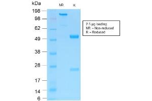 SDS-PAGE Analysis of Purified NGFR Rabbit Recombinant Monoclonal Antibody ABIN6383799. (Recombinant NGFR anticorps)