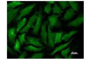 Immunostaining analysis in HeLa cells.