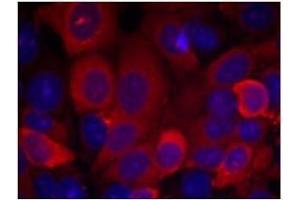 Image no. 1 for anti-3-phosphoinositide Dependent Protein Kinase-1 (PDPK1) (Ser241) antibody (ABIN197100)