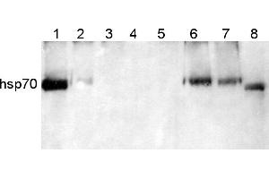 Image no. 1 for anti-Heat Shock Protein 70 (HSP70) (Cytoplasmic) antibody (ABIN334584) (HSP70 anticorps  (Cytoplasmic))
